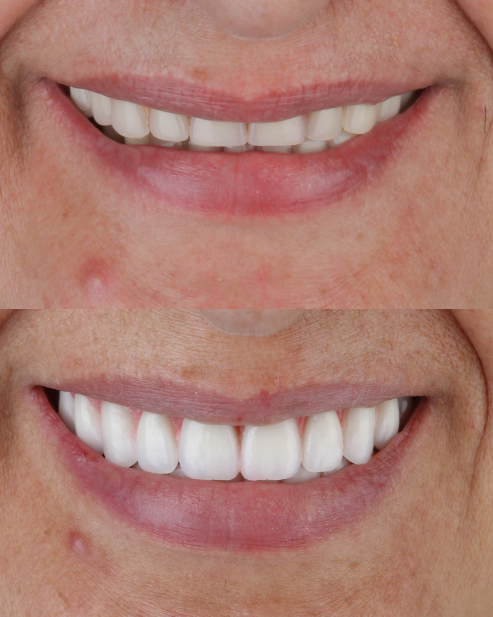 Cópia de Apresentação - Implantes